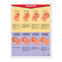 Póster parto
